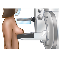 client standing at mammogram machine with breast on detector plate (c) CancerCare Manitoba
